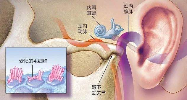 产妇耳朵疼是什么原因(产妇耳朵里面疼是怎么回事)