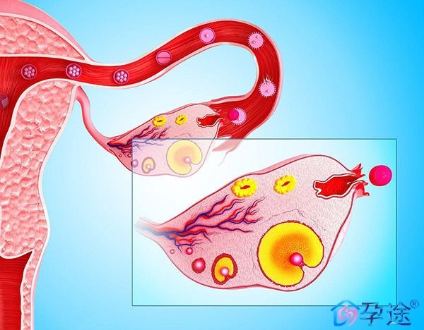 卵巢早衰怎么办还能调整回来吗(35岁卵巢早衰怎么办还能调整回来吗)