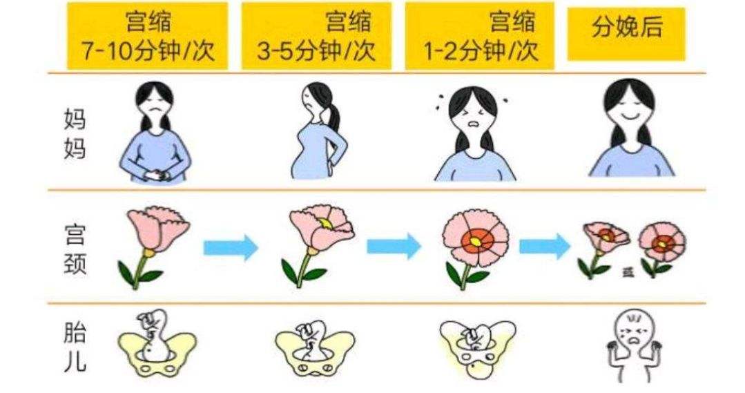 初产妇第二产程时间(第二产程初产妇和经产妇的时间)