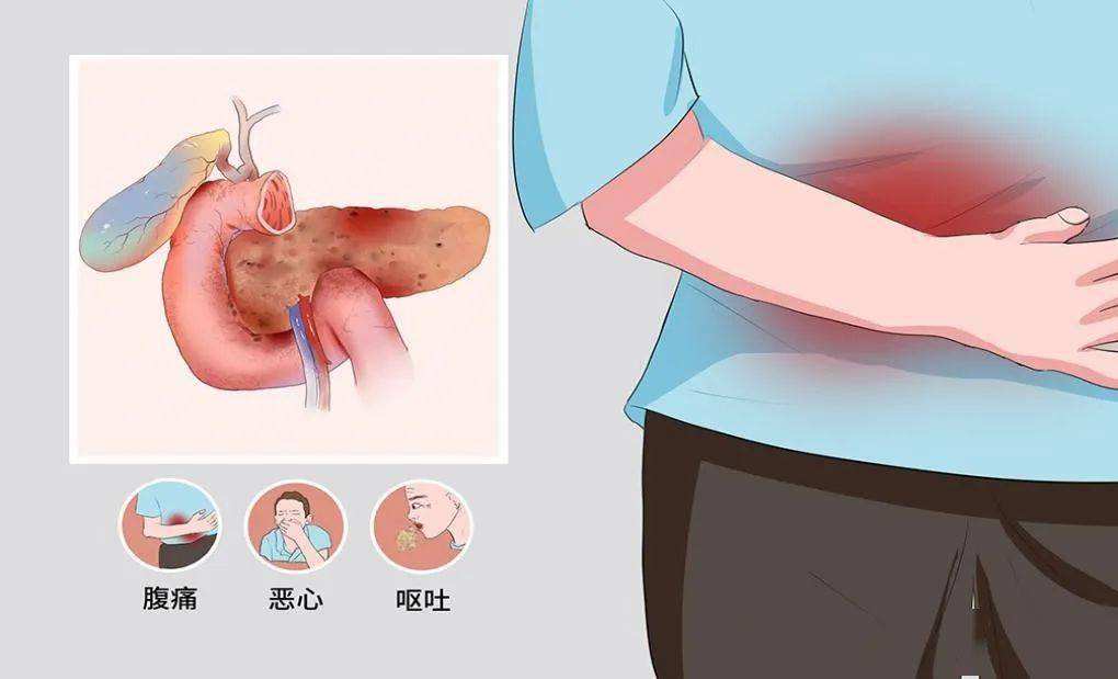 胰腺炎是什么症状(猫咪得了胰腺炎是什么症状)